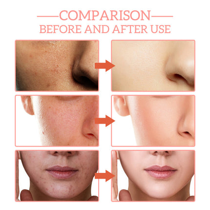 5-in-1 Facial Essence, Deep Moisturizing, Skin Brightening, Firming, Reduce Spot & Wrinkle Acne, Anti-Aging  Jaysuing