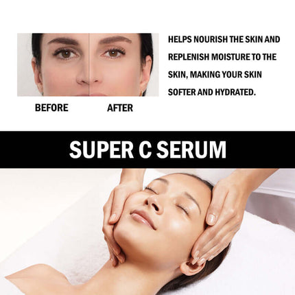 Vitamin C Serum,Brighten Skin Tone, Deep Hydration, Moisturize And Nourish, Soften And Refine, Tighten Skin, Hyaluronic Acid Serum,Help Reduce Wrinkles   EELHOE