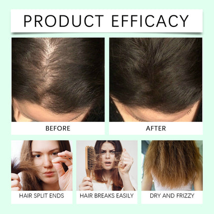 Hair Essential Oil, Rosemary Oil, Strengthening & Softening Hair, Nourishing Hair Oil, Refreshing & Non-Greasy, Reducing Hair Loss, Plant Extract Essential Oil Hoegoa