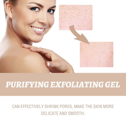 Facial Exfoliating Gel, Deep Skin Cleansing,  Gentle Cleaning, Pore Tightening, Skin Tenderizing, Skin Brightening, Blackhead Reduction, Acne & Impurity Control   OUHOE