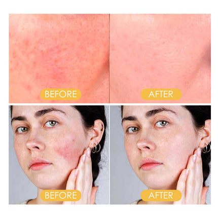 Setting Powder, Daily Makeup, Waterproof & Concealing, Natural & Lightweight, Breathable, Easy Application, Oil Control, Long-Lasting & Smudge-Proof  EELHOE