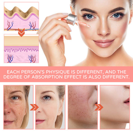 5-in-1 Facial Essence, Deep Moisturizing, Skin Brightening, Firming, Reduce Spot & Wrinkle Acne, Anti-Aging  Jaysuing