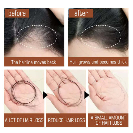 Batana Oil Hair Conditioner, Reduce Hair Loss,Deep Moisturizing, Hydrating, Improve Dry and Frizzy Hair, Silky Smooth and Voluminous, Brighten Shine, Hair Care  EELHOE