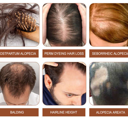 Batana Oil Hair Conditioner, Reduce Hair Loss,Deep Moisturizing, Hydrating, Improve Dry and Frizzy Hair, Silky Smooth and Voluminous, Brighten Shine, Hair Care  EELHOE