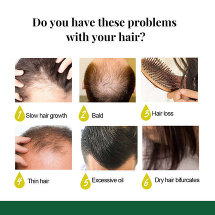 Ginger Hair Spray, Scalp Massage, Hair Repair, Plant Extracts, Oil Control & Refreshing, Hair Care Liquid,Strengthen Hair,Hair Repair,Convenient Spray Design for Easy Use  EELHOE