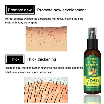 Ginger Hair Spray, Scalp Massage, Hair Repair, Plant Extracts, Oil Control & Refreshing, Hair Care Liquid,Strengthen Hair,Hair Repair,Convenient Spray Design for Easy Use  EELHOE