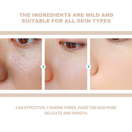 Facial Exfoliating Gel, Deep Skin Cleansing,  Gentle Cleaning, Pore Tightening, Skin Tenderizing, Skin Brightening, Blackhead Reduction, Acne & Impurity Control   OUHOE