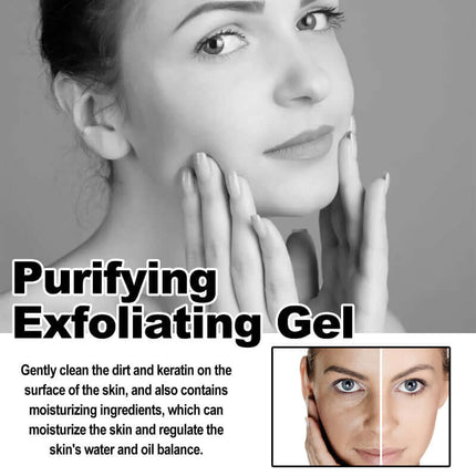 Deep Exfoliating Gel, Gentle Formula, Brighten Complexion, Smooth & Glow Skin,Cleanse Dead Skin & Dirt, Tighten Pores  West Month