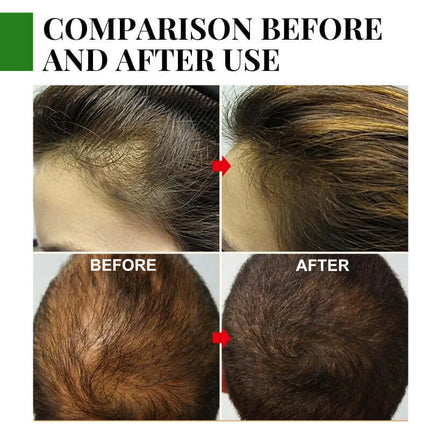 Rosemary Hair Essential Oil,  Mild Scalp Care, Deep Moisturizing ,Silky Shine, Natural Volume, Hair Thickening, Reduces Hair Loss,Hair Care,Plant extract, Easy to Absorb,Convenient to use EELHOE