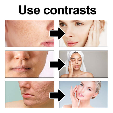 Deep Exfoliating Gel, Gentle Formula, Brighten Complexion, Smooth & Glow Skin,Cleanse Dead Skin & Dirt, Tighten Pores  West Month