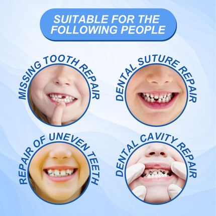 Solid Tooth Gum, Tooth Modification, Temporary Cavity Filling, Tooth Filling Gum, Denture Gap Filling, Tooth Gum Filling, High Viscosity, Not Easy to Fall Off, High-Temperature Rapid Molding, Safe Ingredients  South Moon
