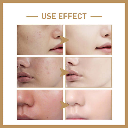 Rice Facial Toner, Deep Hydration, Skin Barrier Repair, Tightening & Moisturizing, Oil Control, Refreshing Non-Greasy, Skin Tone Brightening, Fast Absorption, Exfoliating, Pore Tightening  EELHOE