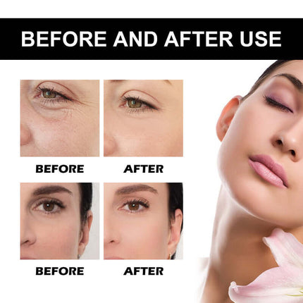 Vitamin C Serum,Brighten Skin Tone, Deep Hydration, Moisturize And Nourish, Soften And Refine, Tighten Skin, Hyaluronic Acid Serum,Help Reduce Wrinkles   EELHOE