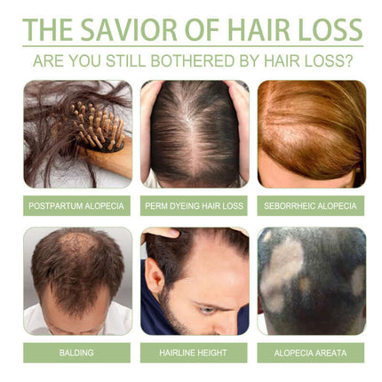 Herbal Hair Oil, Hair Cleansing, Gentle Scalp Nourishment, Strengthen Hair, Scalp Cleaning, Hair Care, Smooth Hair Oil, Reduce Hair Loss  OUHOE