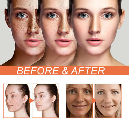 Concealer BB Cream,Brightens & Evens Skin Tone, Hydrates, Refreshing & Non-Greasy, Covers Spots & Acne Scars, Natural Complexion, Lazy Makeup  EELHOE
