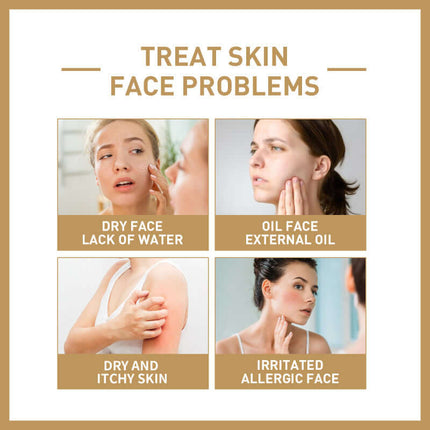 Rice Facial Toner, Deep Hydration, Skin Barrier Repair, Tightening & Moisturizing, Oil Control, Refreshing Non-Greasy, Skin Tone Brightening, Fast Absorption, Exfoliating, Pore Tightening  EELHOE