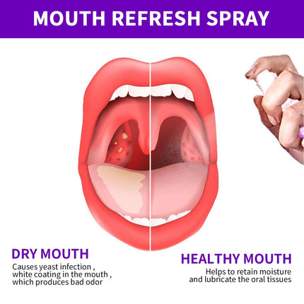 Fresh Oral Spray, Eliminate Bad Breath, Refresh Breath, Long-Lasting Fragrance, Portable Spray, Prevent Odor EELHOE