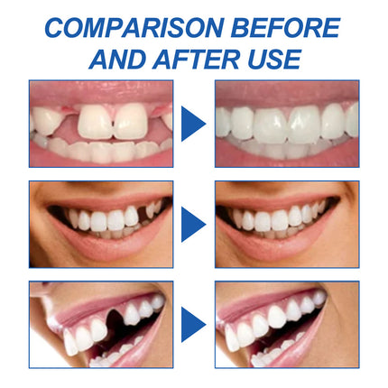 Solid Tooth Gum, Tooth Modification, Temporary Cavity Filling, Tooth Filling Gum, Denture Gap Filling, Tooth Gum Filling, High Viscosity, Not Easy to Fall Off, High-Temperature Rapid Molding, Safe Ingredients  South Moon