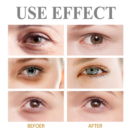 Eye Firming Gel, Tighten Eye Skin, Brighten Complexion, Eye Cream, Reduce Fine Lines, Dark Circles, Deep Hydration   West Month